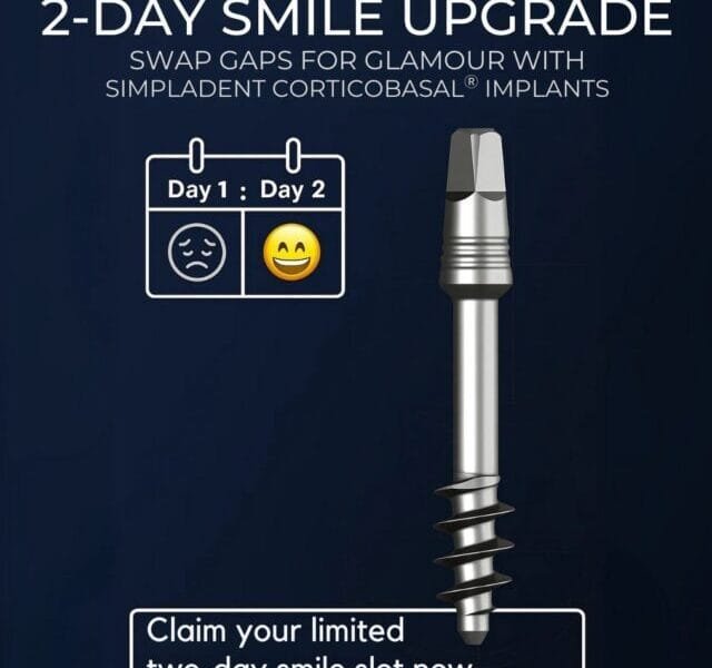 Day Smile Upgrade with Same-Day Dental Implants | Fast Cosmetic Dentistry Solutions