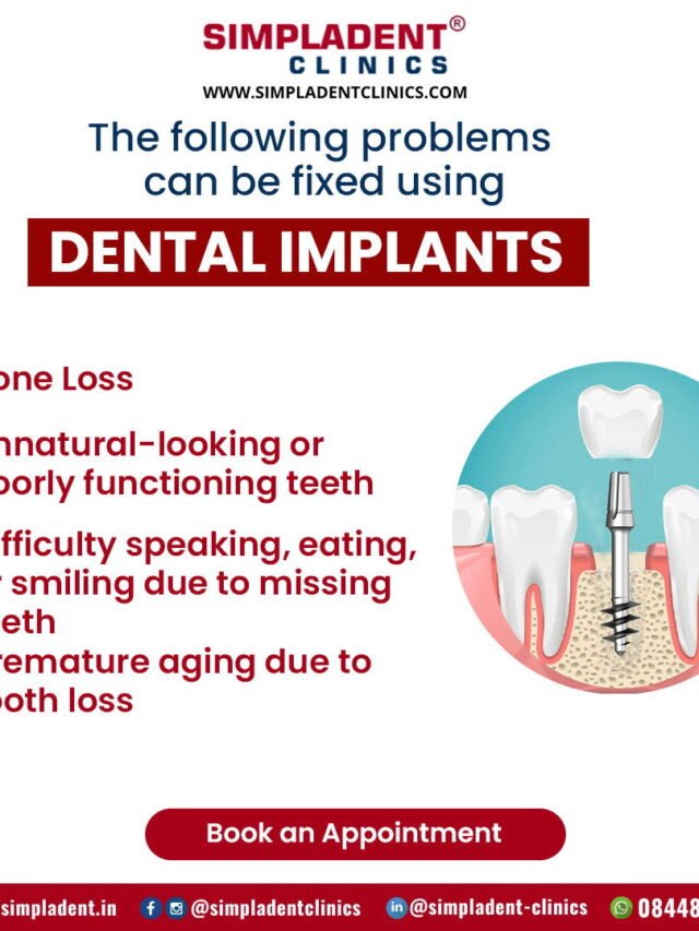 Affordable Dental Implants in India