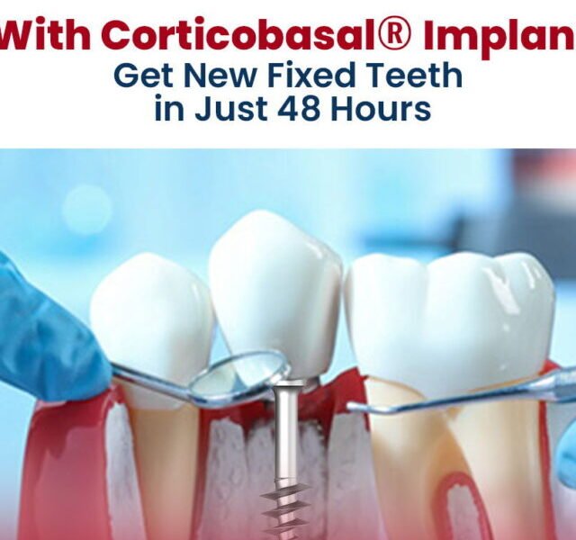 Affordable Dental Implants at Simpladent Clinics