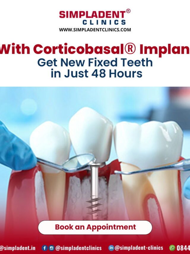 Best dental implants in India