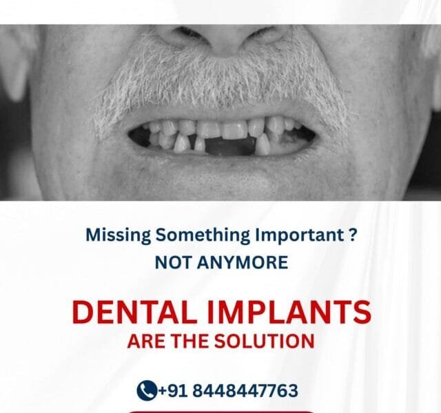 Affordable Dental Implants – Permanent Tooth Replacement by Top Cosmetic Dentists