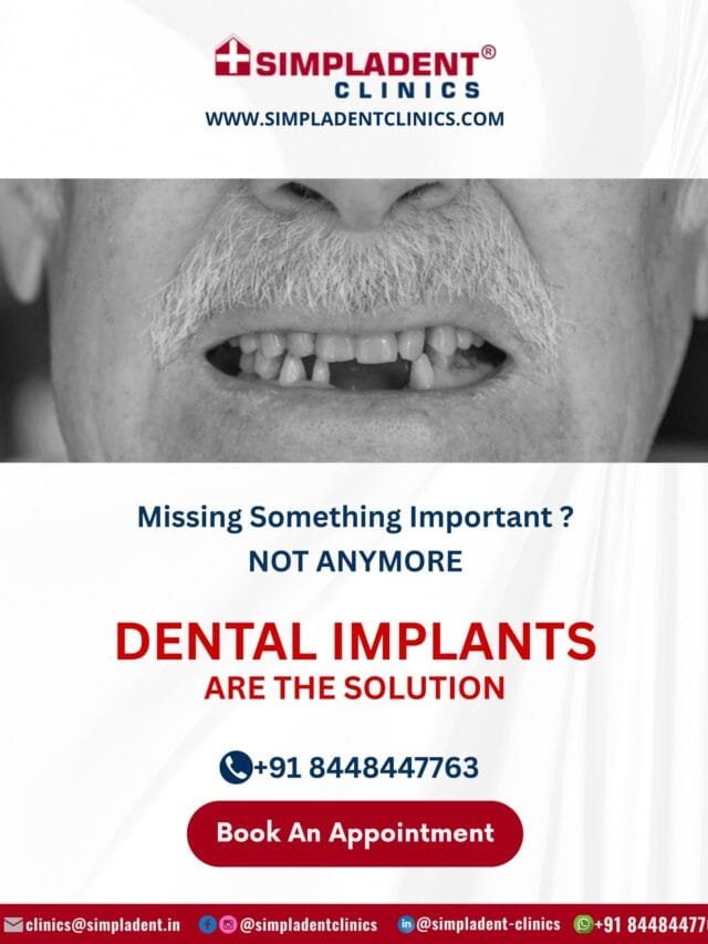 Discover the Best Dental Implant Clinic in India for World-Class Smiles!