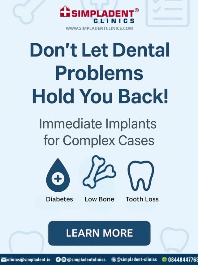 Best Dental Surgeon in Delhi – Dr Vivek Gaur: Leading Implantologist for Same‑Day Fixed Teeth