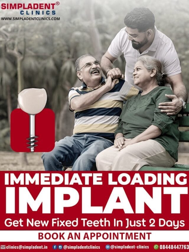 Immediate Loading Implant • Same‑Day Teeth & Rapid Smile Restoration
