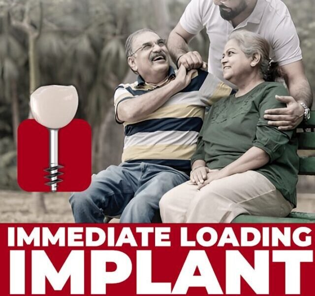 Immediate Loading Implants – Same Day Fixed Teeth with No Bone Graft in India