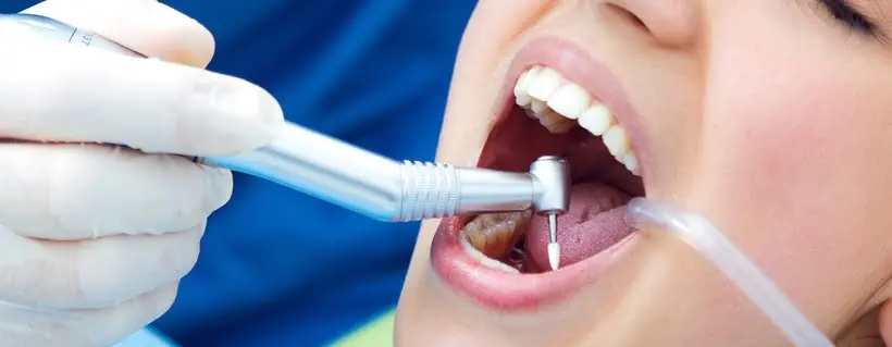 Post-Implant Care Dental Services | Oral Health | Implant Aftercare | Dental Implant Recovery | Tooth Replacement