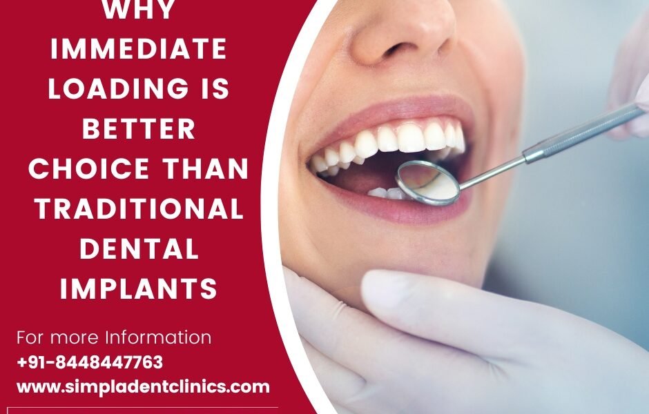 Corticobasal Immediate Loading Implants, dental restoration, tooth replacement, dental implantology, advanced dental technology