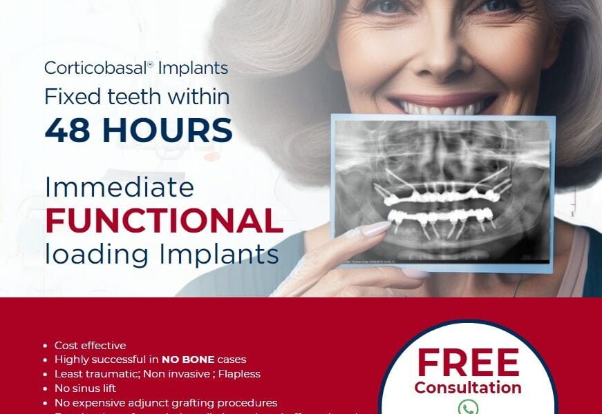 Dental Implant Solution - Smile Transformation | Simpladent Clinics