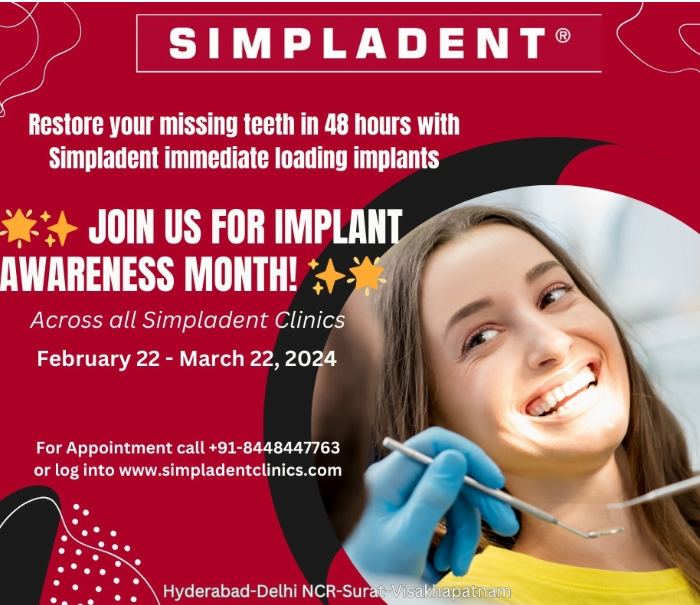 Dental Implants, Tooth Replacement, Smile Restoration, Implant Awareness, Dental Health