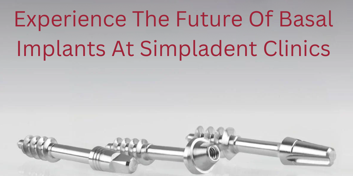Advanced Basal Implants for permanent teeth replacement, innovative dental implantology, durable dental solutions, cutting-edge implant technology, fast teeth restoration.