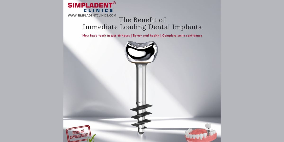Immediate loading dental implants India