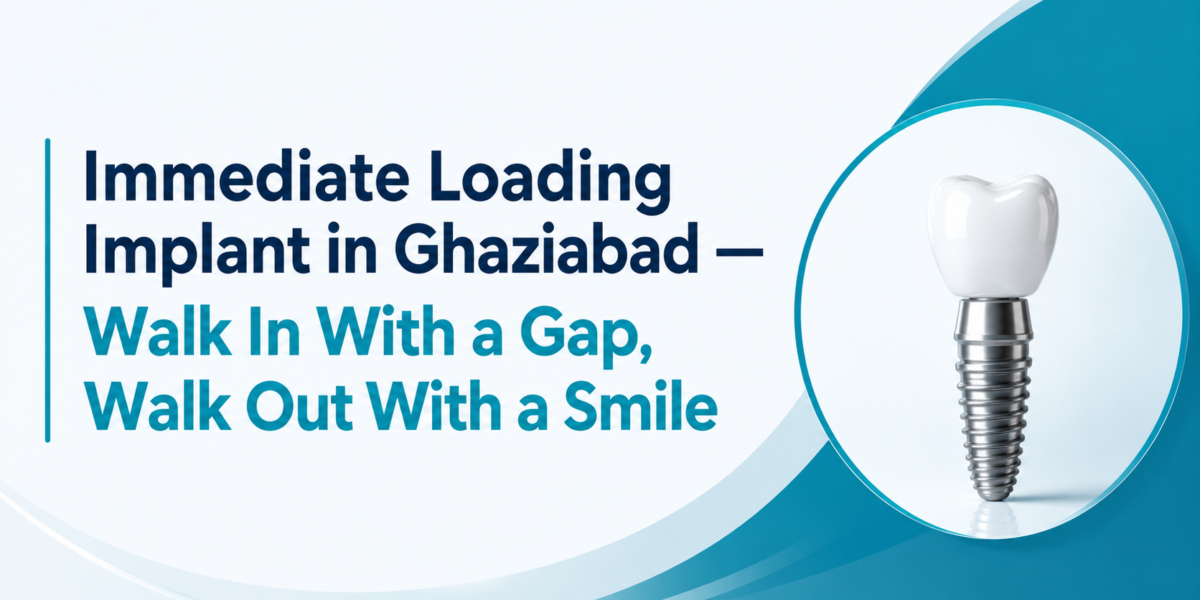 Immediate Loading Implants