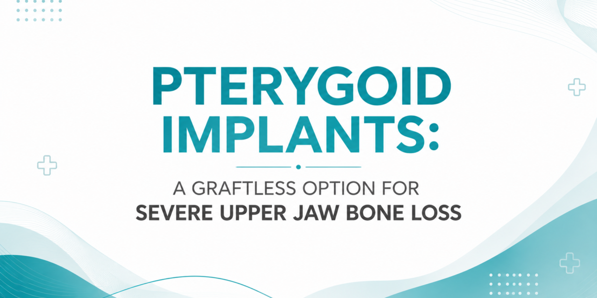 immediate loading implants