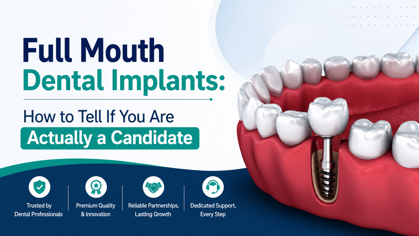 Full Mouth Dental Implants