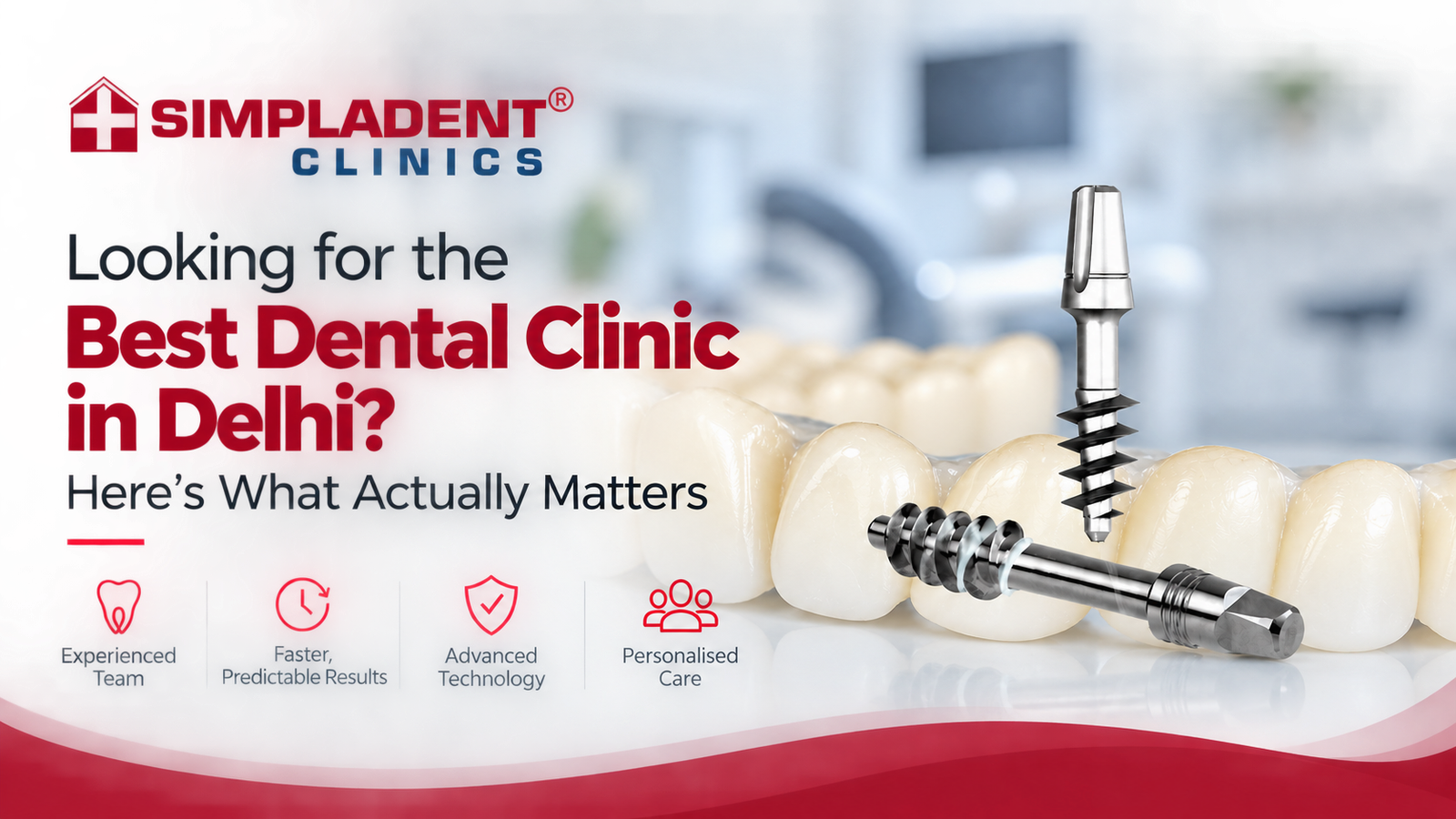 Best Dental Implant Clinic in Delhi