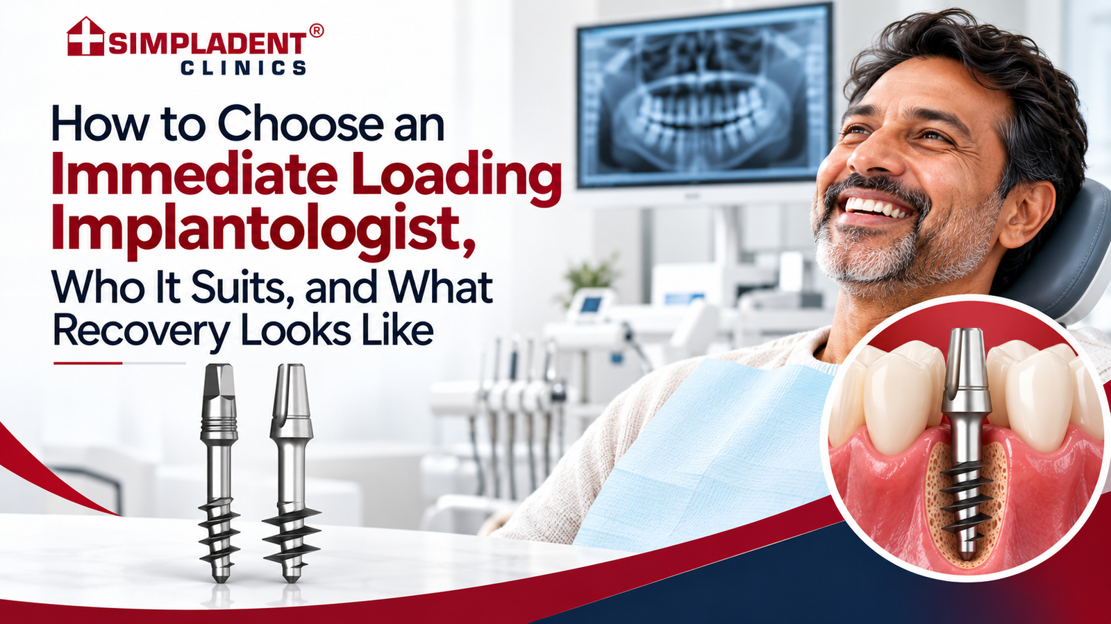 Immediate Loading Implantologist at Simpladent Clinics for Strategic Dental Implants in India